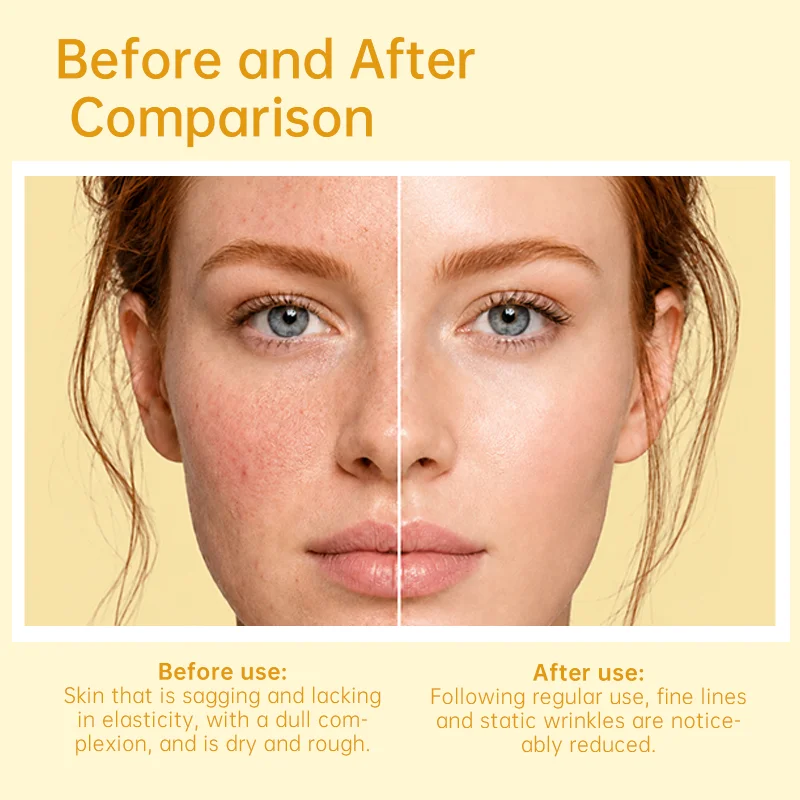 Side-by-side comparison of a woman's face showing skin improvements, with text describing changes before and after treatment.